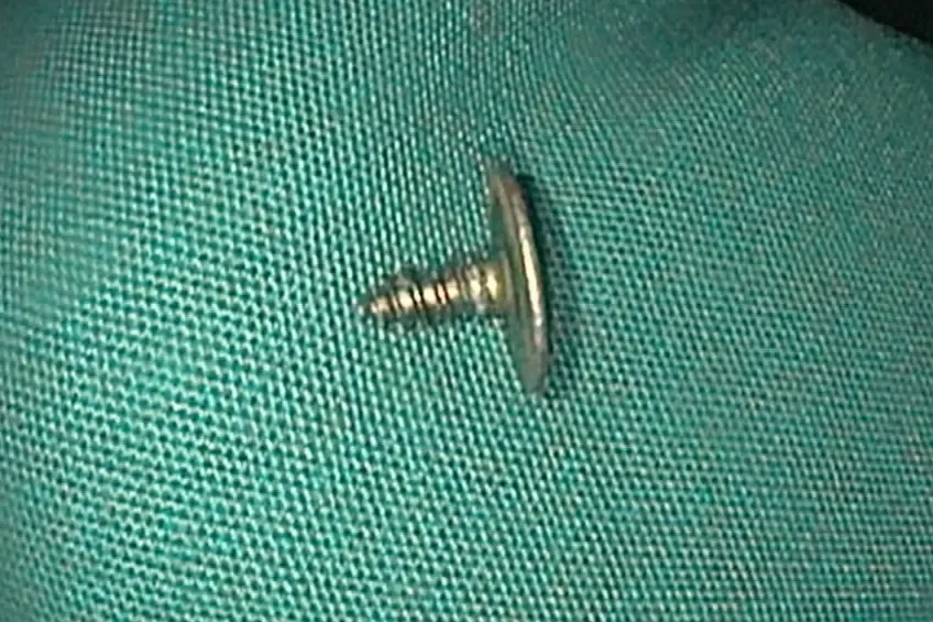 Chiếc ốc vít sắc nhọn được gắp ra